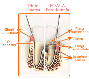 toothdiagram