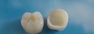 zirconium-crowns